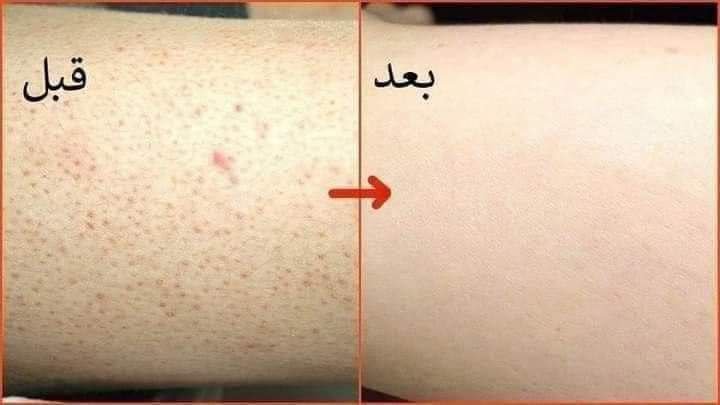 مجموعه حمام مغربى صفاء غنيم - الصورة 3