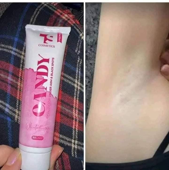 كريم كاندى لتفتيح - الصورة 5